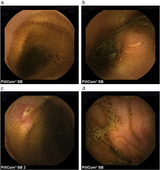 Fig. 1