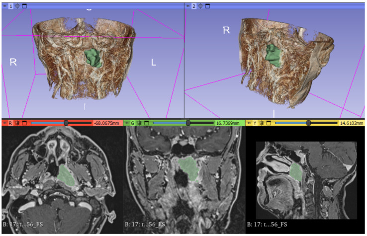 Figure 2