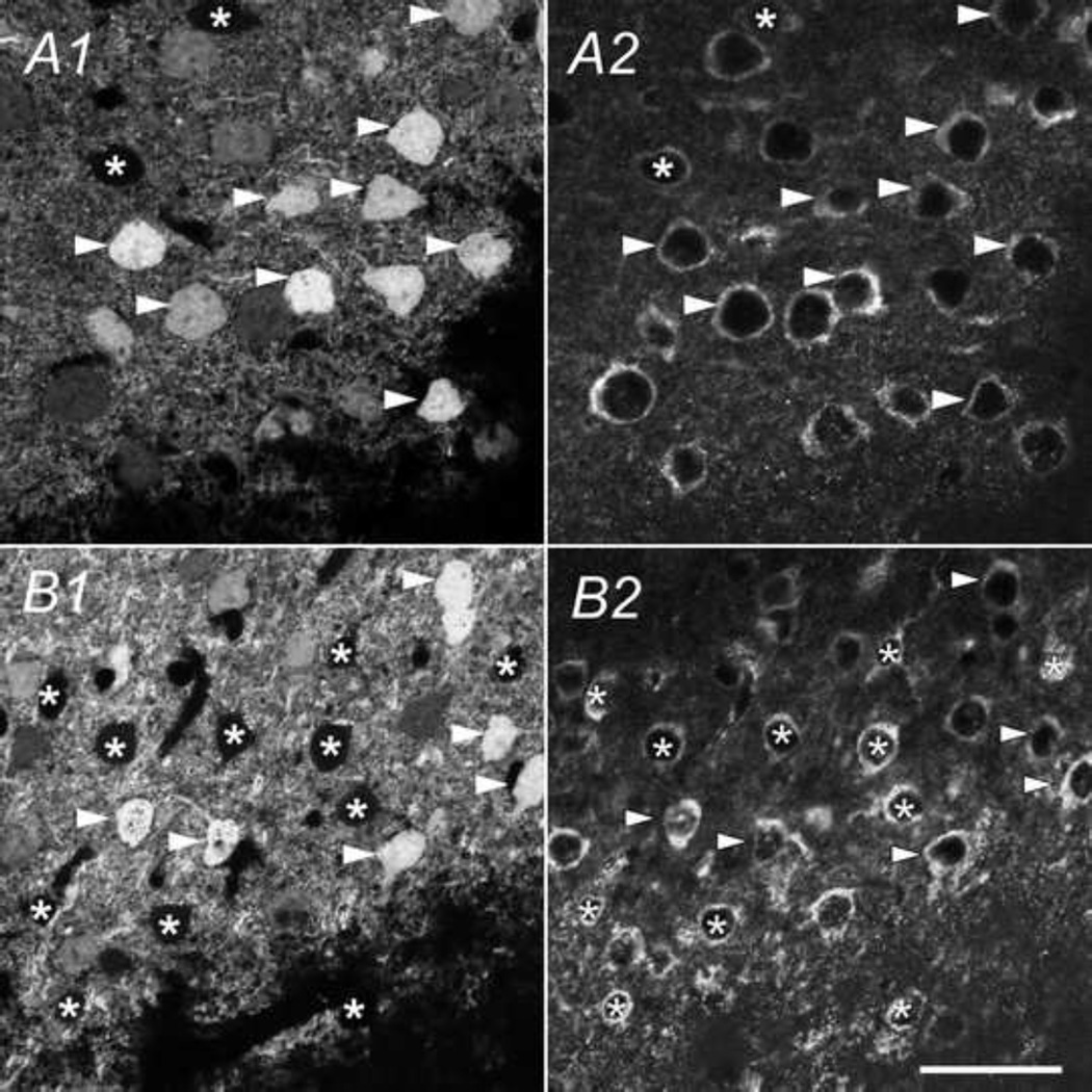 Fig. 12