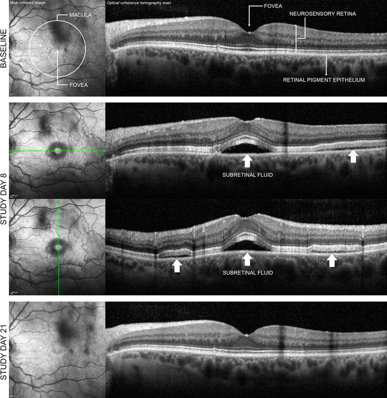 Fig. 1