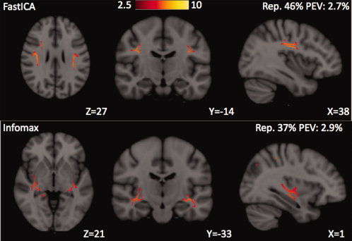 Figure 11