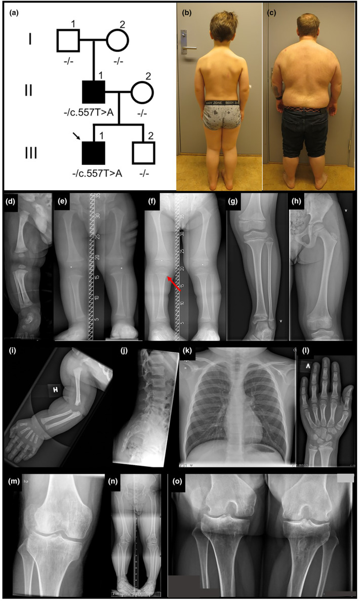 FIGURE 3