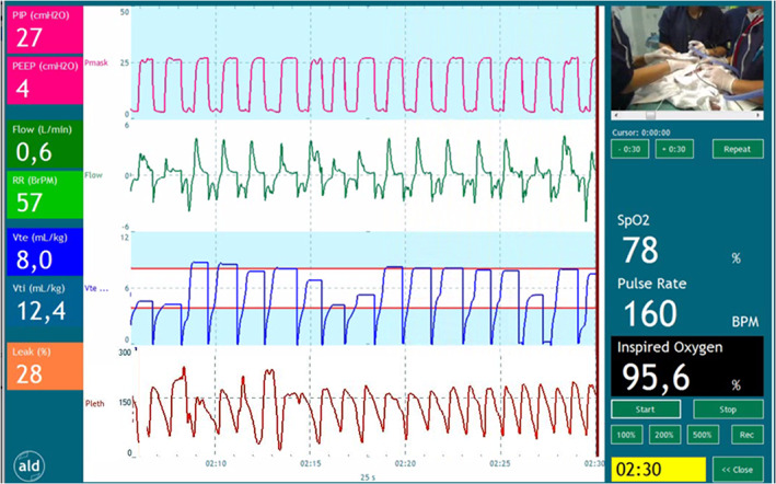 FIGURE 1