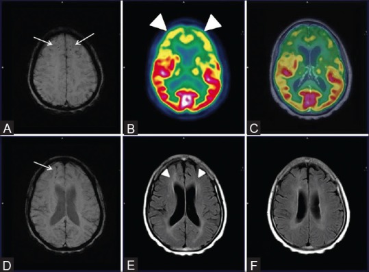 Figure 11 (A-F)