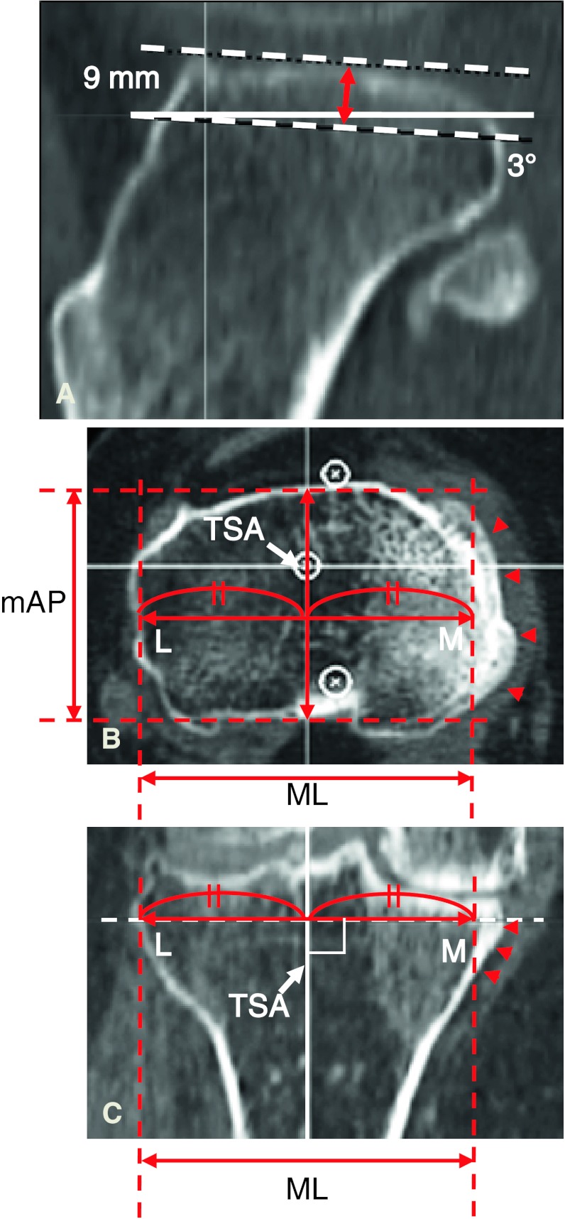 Fig. 2A–C