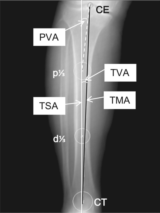 Fig. 1