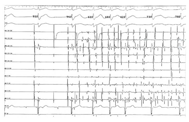 Figure 2.