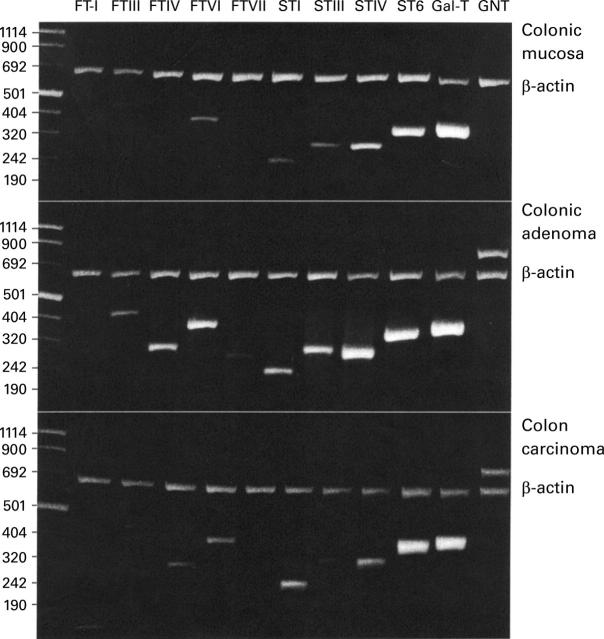 Figure 1  