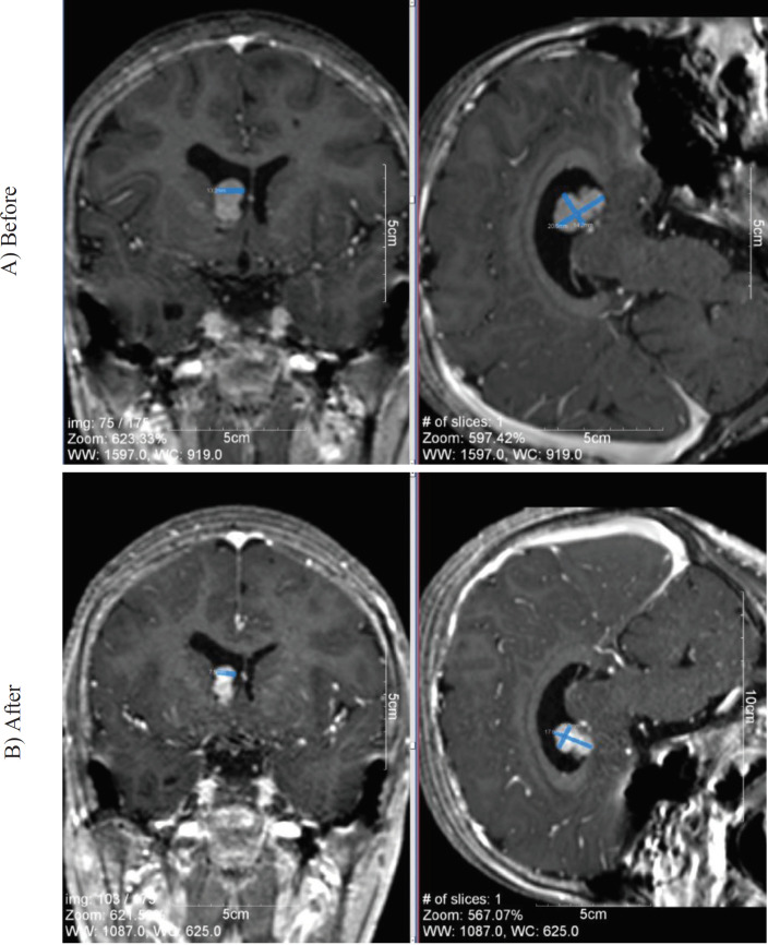 Fig1