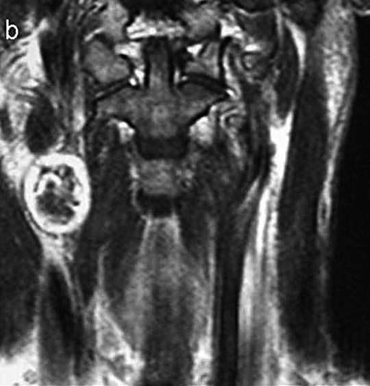 Fig. 1b.