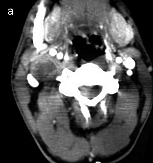 Fig. 1a.