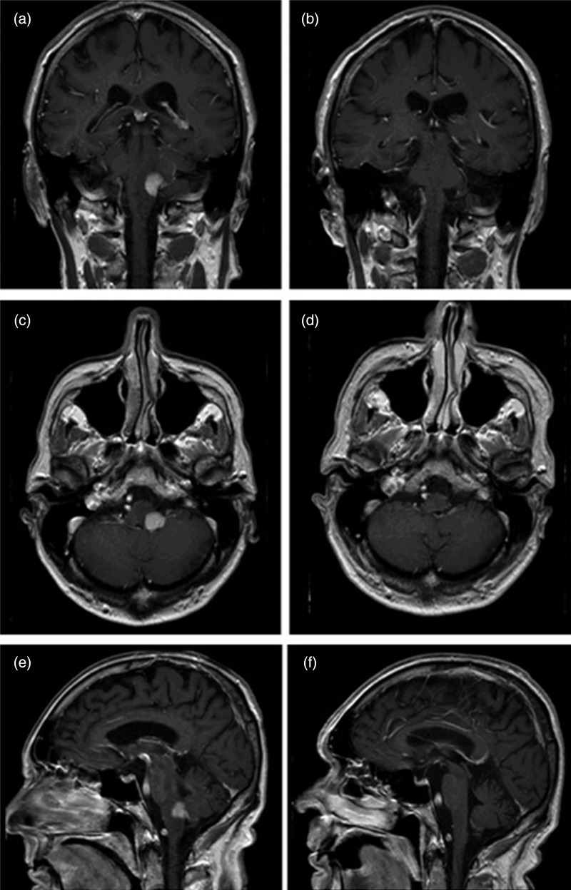 Figure 2: