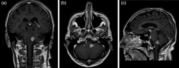 Figure 1: