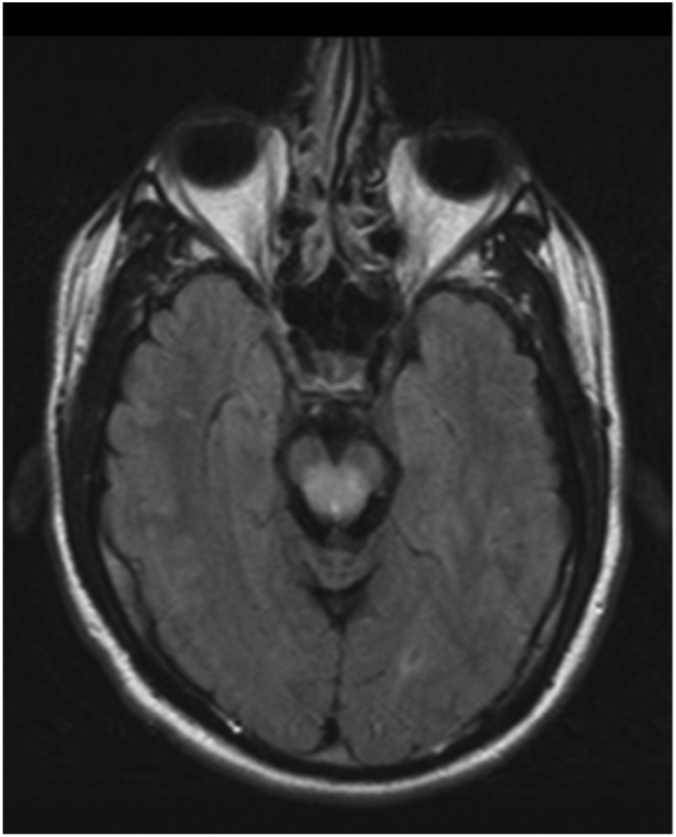 Fig 1E