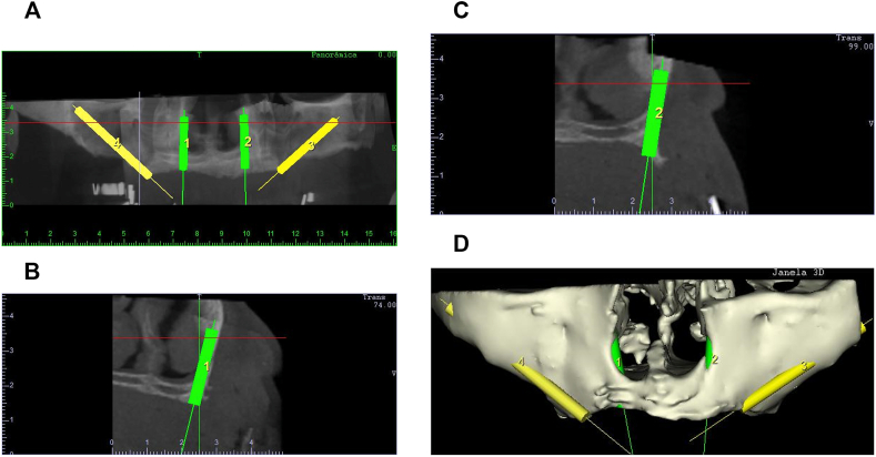 Fig. 1