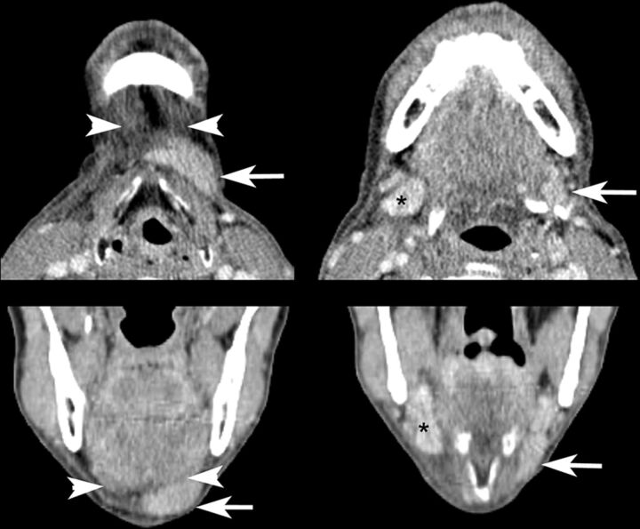 Fig 2.