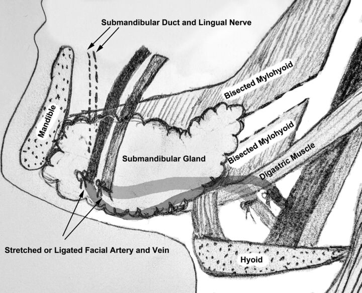 Fig 1.