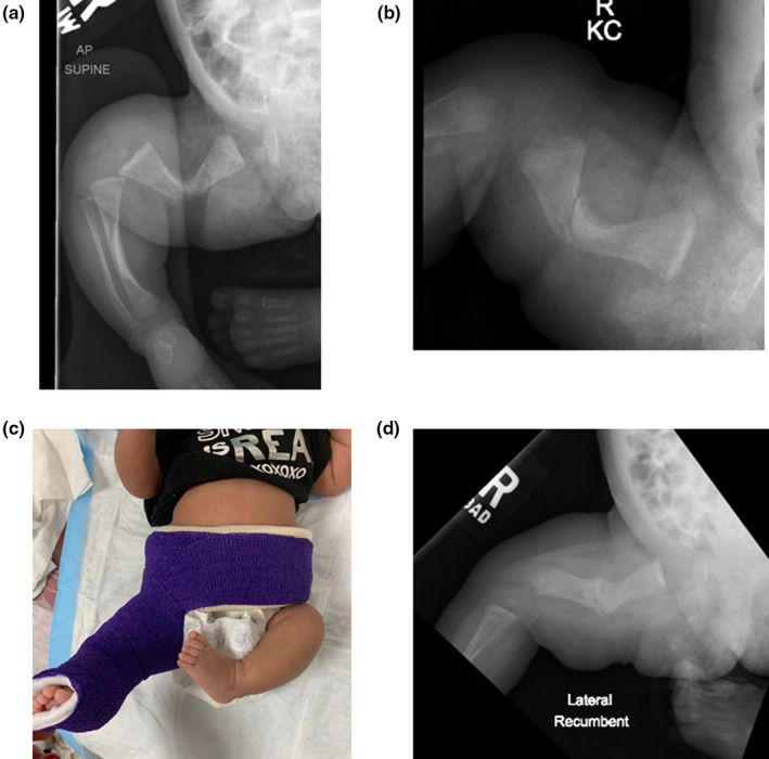 FIGURE 3