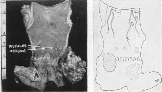 Fig. 12