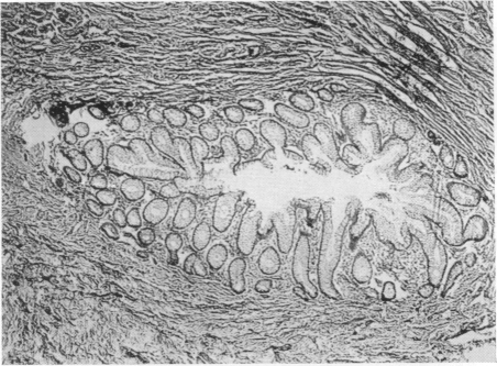 Fig. 15