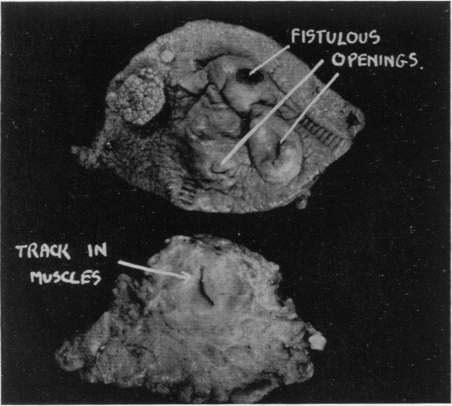 Fig. 14