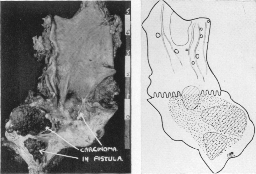 Fig. 11