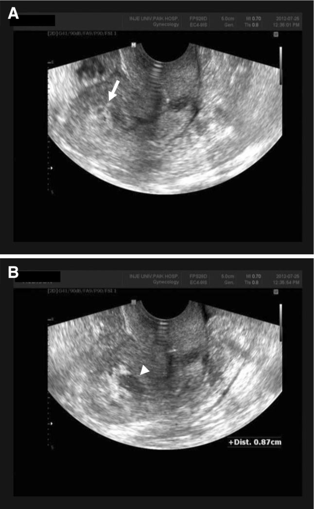 Fig. 1