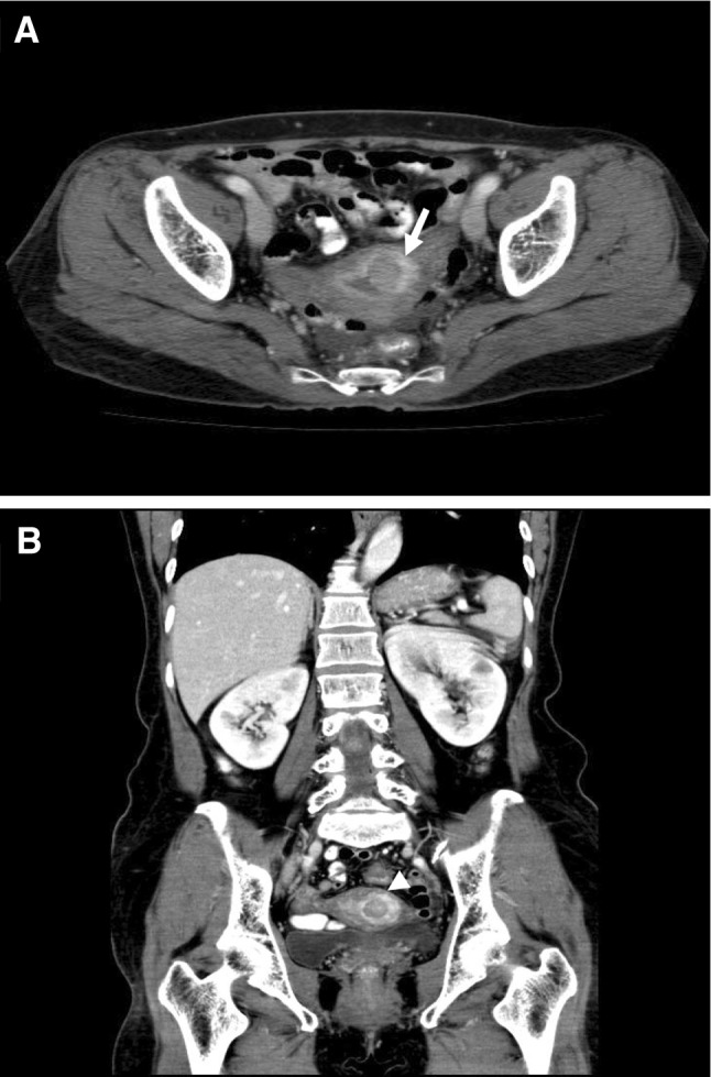 Fig. 2