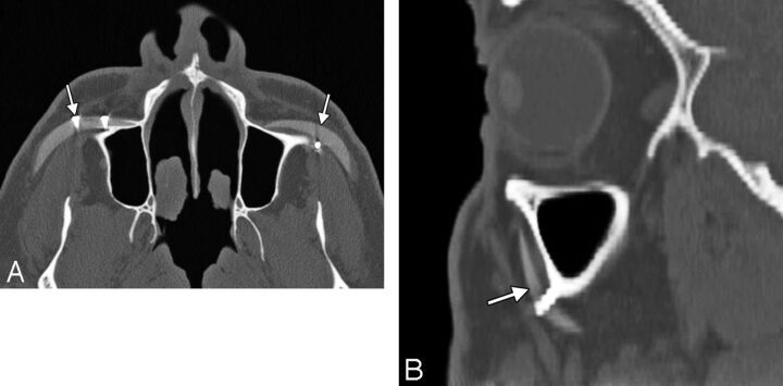 Fig 3.