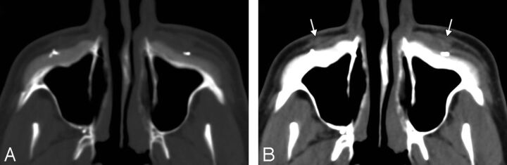 Fig 16.