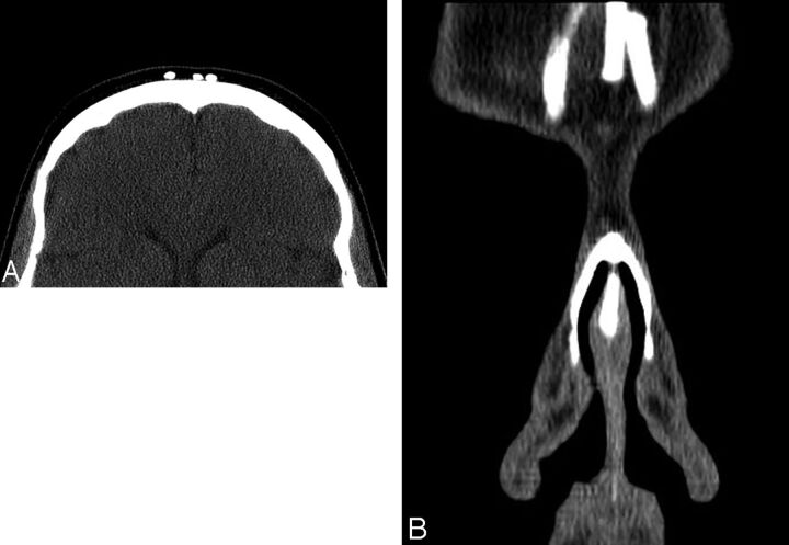 Fig 1.