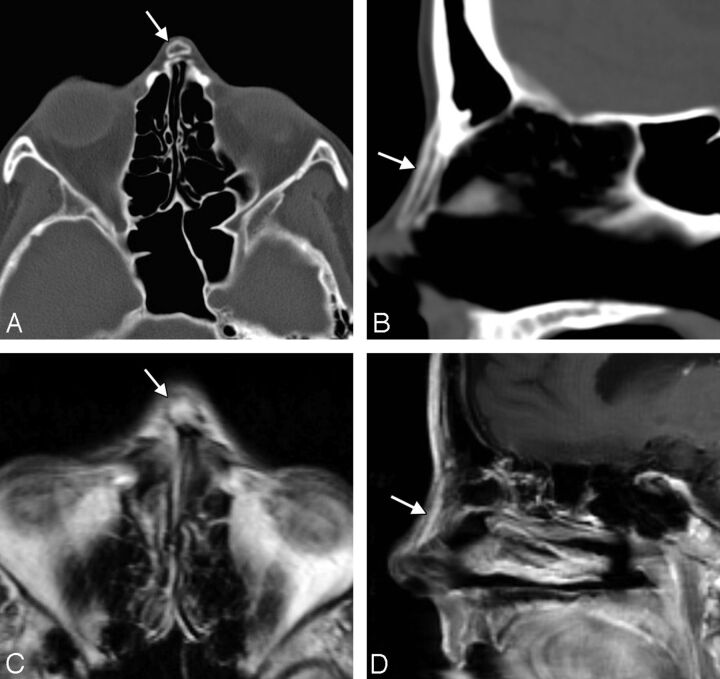 Fig 5.