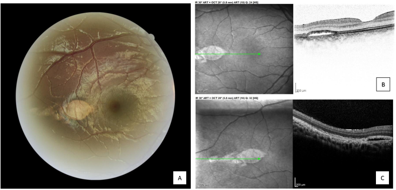 Fig. 1