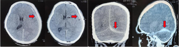 Fig 1