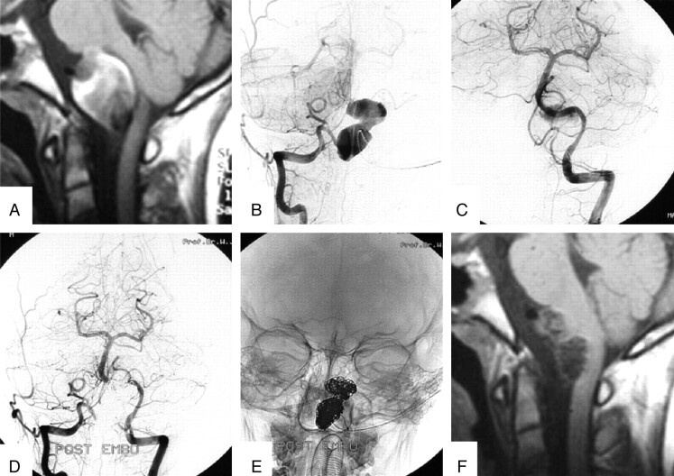 Fig 3.