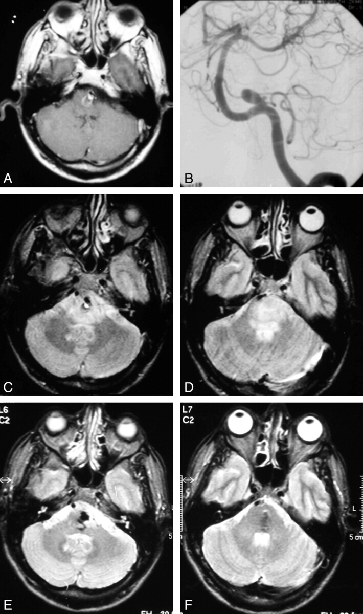 Fig 4.