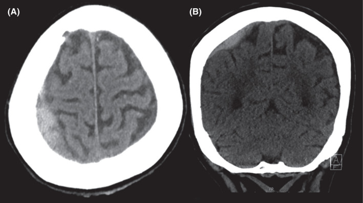 FIGURE 1