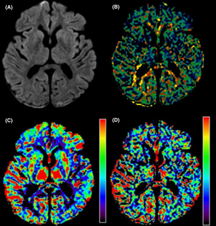 FIGURE 3