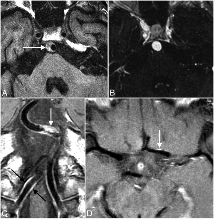 Fig 6.