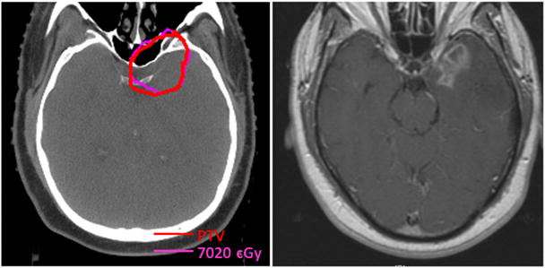 Fig 5