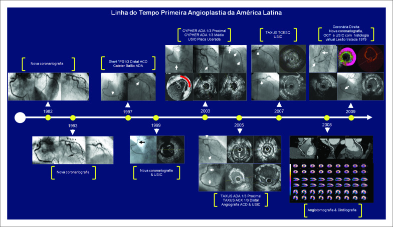 Figura 2