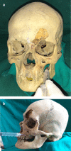 Fig. 2