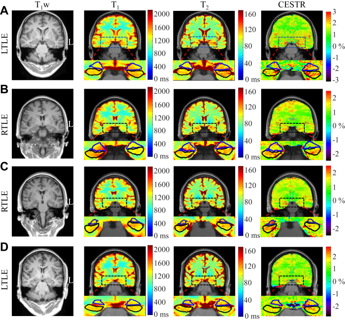 Fig. 4