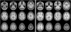 Fig. 13