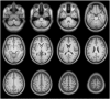 Fig. 12