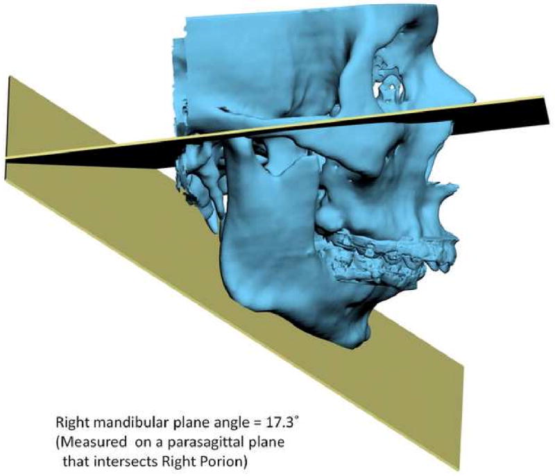 Fig 13