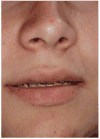Fig 15
