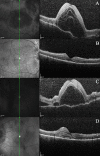 Fig. 2