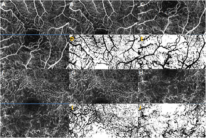 Fig. 4