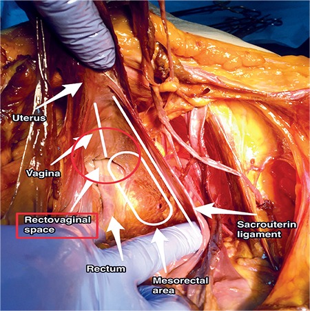 Figure 22